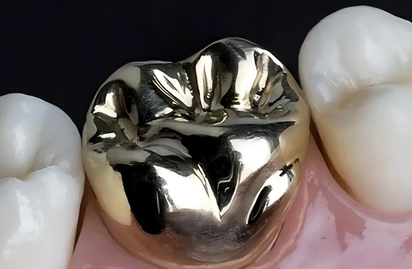 Semi-Precious Gold Crown
